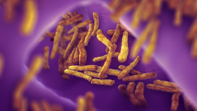 Tuberculosis (TB) a.k.a consumption, a.k.a the "white death" is a serious infectious disease caused by the bacterium Mycobacterium tuberculosis. The bacteria usually affects the lungs and can be fatal