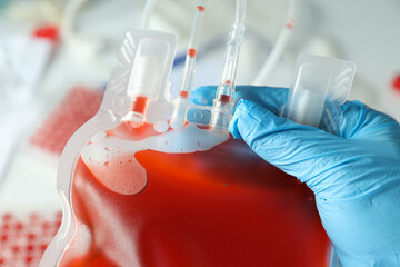 Bag with donor blood in doctor's hand on light background, close up