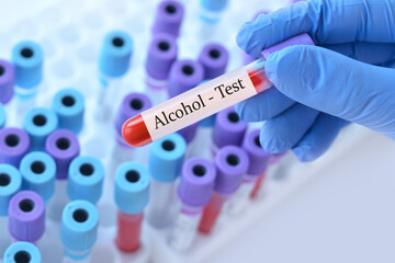 Doctor holding a test blood sample tube with Alcohol test on the background of medical test tubes...