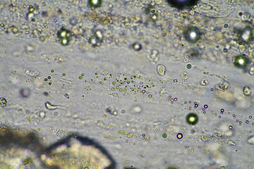 green mucus and coughing up phlegm under the microscope looking at influenza cells and cold snot...