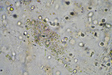 green mucus and coughing up phlegm under the microscope looking at influenza cells and cold snot...