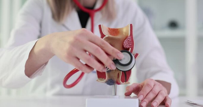 Anatomical model of the rectum, examined by a doctor. Methods for examining rectum concept