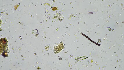 soil microorganisms in a soil life sample from a sustainable agriculture farm. living food web or bacteria fungi and protozoa