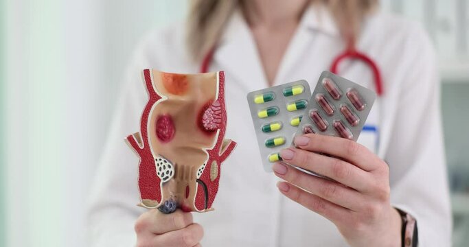 Doctor proctologist holding blisters with pills and anatomical model of rectum