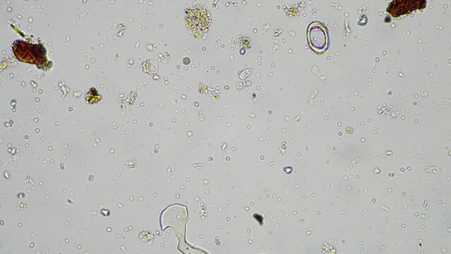 soil microorganisms in a soil life sample from a sustainable agriculture farm. living food web or bacteria fungi and protozoa