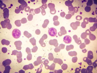 Giant platelets, Neutrophils and Red blood cells (RBC) analysed by light microscope