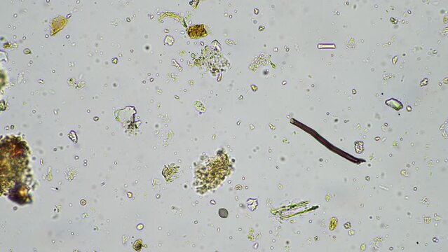 soil microorganisms in a soil life sample from a sustainable agriculture farm. living food web or bacteria fungi and protozoa