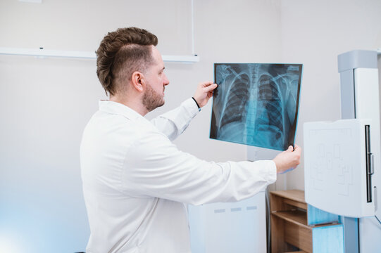 male doctor examines pictures of the lungs and ribs in the x-ray room, in the background x ray machine