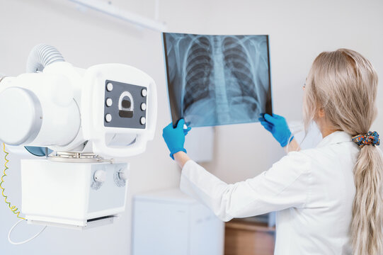 female doctor examines pictures of the lungs and ribs in the x-ray room
