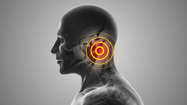 Mastoid region discomfort that trigger pain