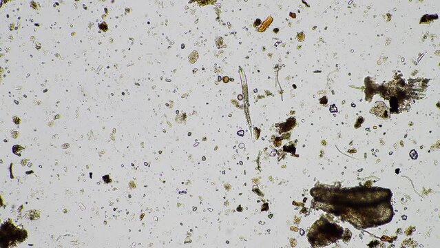 soil microorganisms in a soil life sample from a sustainable agriculture farm. living food web or bacteria fungi and protozoa