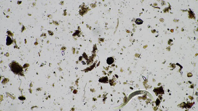 human parasite. gut intestinal infection disease. microorganism infection in hospital