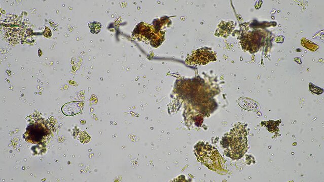 soil microorganisms in a soil life sample from a sustainable agriculture farm. living food web or bacteria fungi and protozoa
