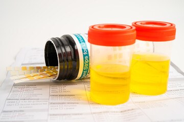 Urinalysis, urine cup with reagent strip pH paper test and comparison chart in laboratory.