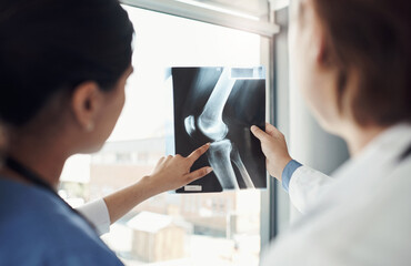 Doctor, nurse and xray in radiology for bones in patient with examination, pointing for treatment...