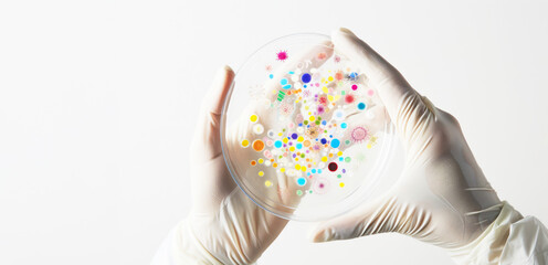 Petri dish with various bacteria cultures culture media with bacteria, Test various germs, virus,...