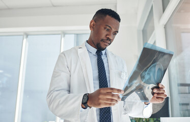 Fototapeta premium Hospital, doctor and black man with xray in office for neurology results, healthcare and assessment. Medical professional, clinic and person with radiology film for neuroscience, analysis and review