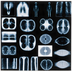 X-ray images from patient, ai-generatet - 796650556
