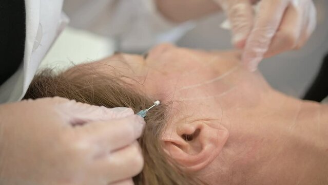 A thread facelift as an alternative to traditional facelift surgery