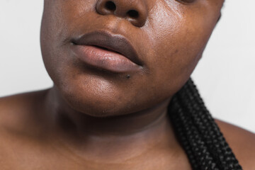 dull brown skin with dark spots, hyperpigmentation on brown skin, african american woman with skin...