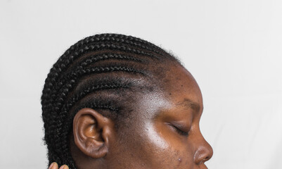 Brown skin with dark spots, hyperpigmentation on brown skin, african american woman with skin...