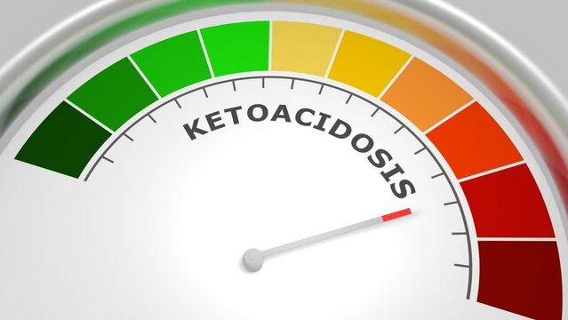 Ketoacidosis level on measure scale. Instrument scale with arrow. Colorful infographic gauge element. Ketoacidosis is a metabolic state