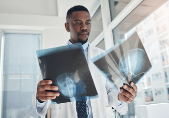 Black doctor, x ray and thinking in hospital for healthcare, surgery and head injury in clinic....