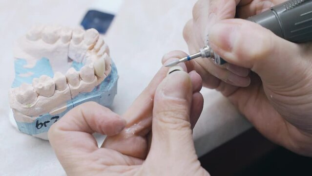 A dental technician cuts and cleans dentures with a milling cutter in a dental laboratory. Close-up