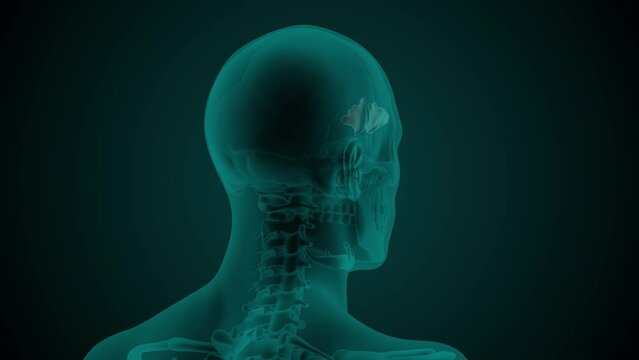 X-ray image of the head of a man with visible paranasal frontal sinus. Anatomically correct 3d animation on dark background