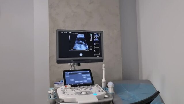 ultrasound monitor with fetus pictures, ultrasound equipment with baby pictures, medical examination of the body of the pregnant woman patient, new life embryo 
