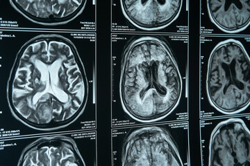 Part of a close-up MRI image of the brain. Diagnosis and treatment of brain diseases.