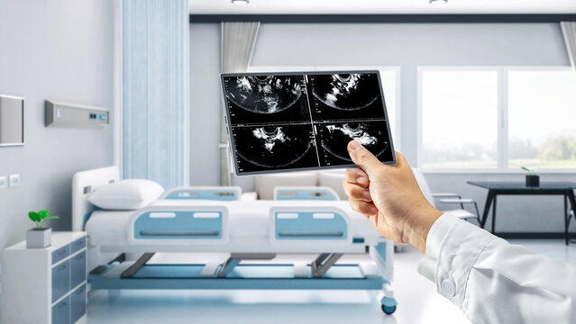 Doctor or sonographer with x-ray film