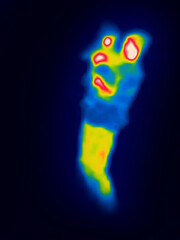 A mother and a crying child.Image from thermal imager device.