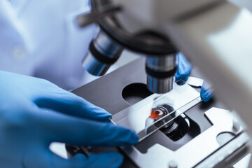 Hands of a doctor or female doctor collecting blood sample tubes from rack with analyzer in lab. Doctor holding blood test tube in research laboratory red blood cells