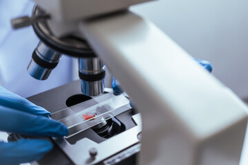 Hands of a doctor or female doctor collecting blood sample tubes from rack with analyzer in lab....