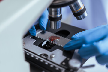 Hands of a doctor or female doctor collecting blood sample tubes from rack with analyzer in lab. Doctor holding blood test tube in research laboratory red blood cells