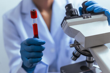 Hands of a doctor or female doctor collecting blood sample tubes from rack with analyzer in lab. Doctor holding blood test tube in research laboratory red blood cells