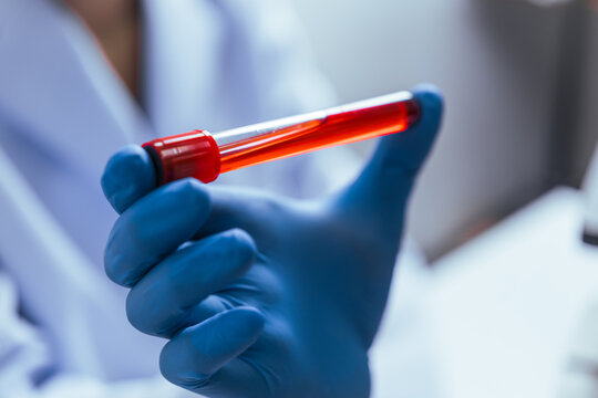 Hands of a doctor or female doctor collecting blood sample tubes from rack with analyzer in lab. Doctor holding blood test tube in research laboratory red blood cells