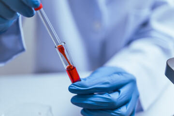 Hands of a doctor or female doctor collecting blood sample tubes from rack with analyzer in lab....