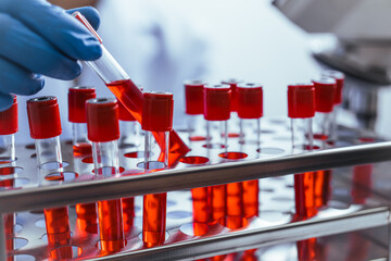 Hands of a doctor or female doctor collecting blood sample tubes from rack with analyzer in lab....