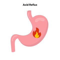 Acid reflux