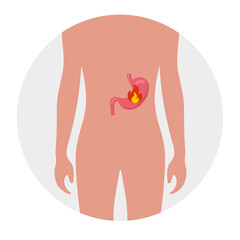 Stomach problem, acid stomach