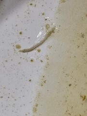 Liver cleaning. Microplastic Detox From Your Body