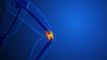 Knee Joint Pain with blue background