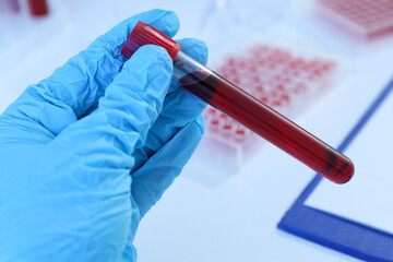 Test tubes with donor blood in doctor's hand on light background, close up