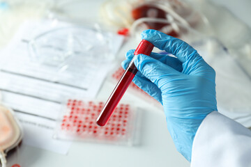 Bag and test tube with donor blood in hand and documents on light background, close up