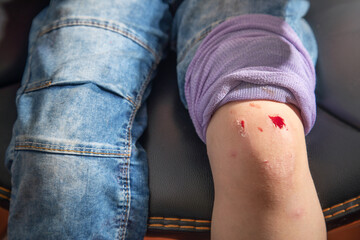  Kid with injured knee and wound.