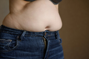 Woman in jeans stands with bulging belly and excess fat on sides. Concept of diet, weight loss,...