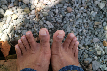 a pair of men legs, dark brown in color. around thirty years old. gravel background