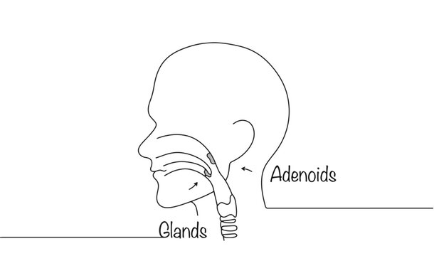 Adenoids and tonsils